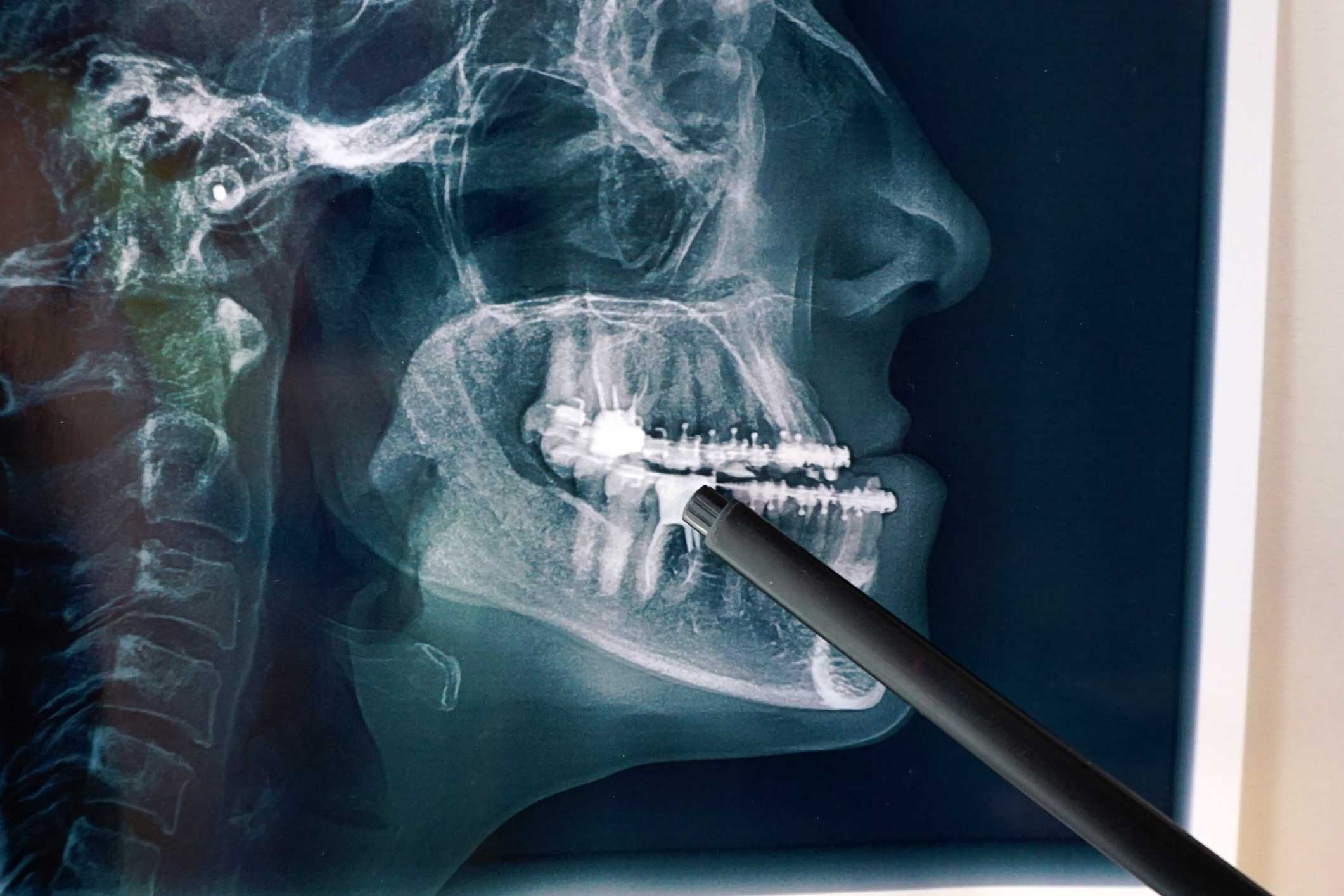 Cirugía Oral en Retiro, cirujano dental en Retiro, Madrid; cirugía bucal en Retiro.