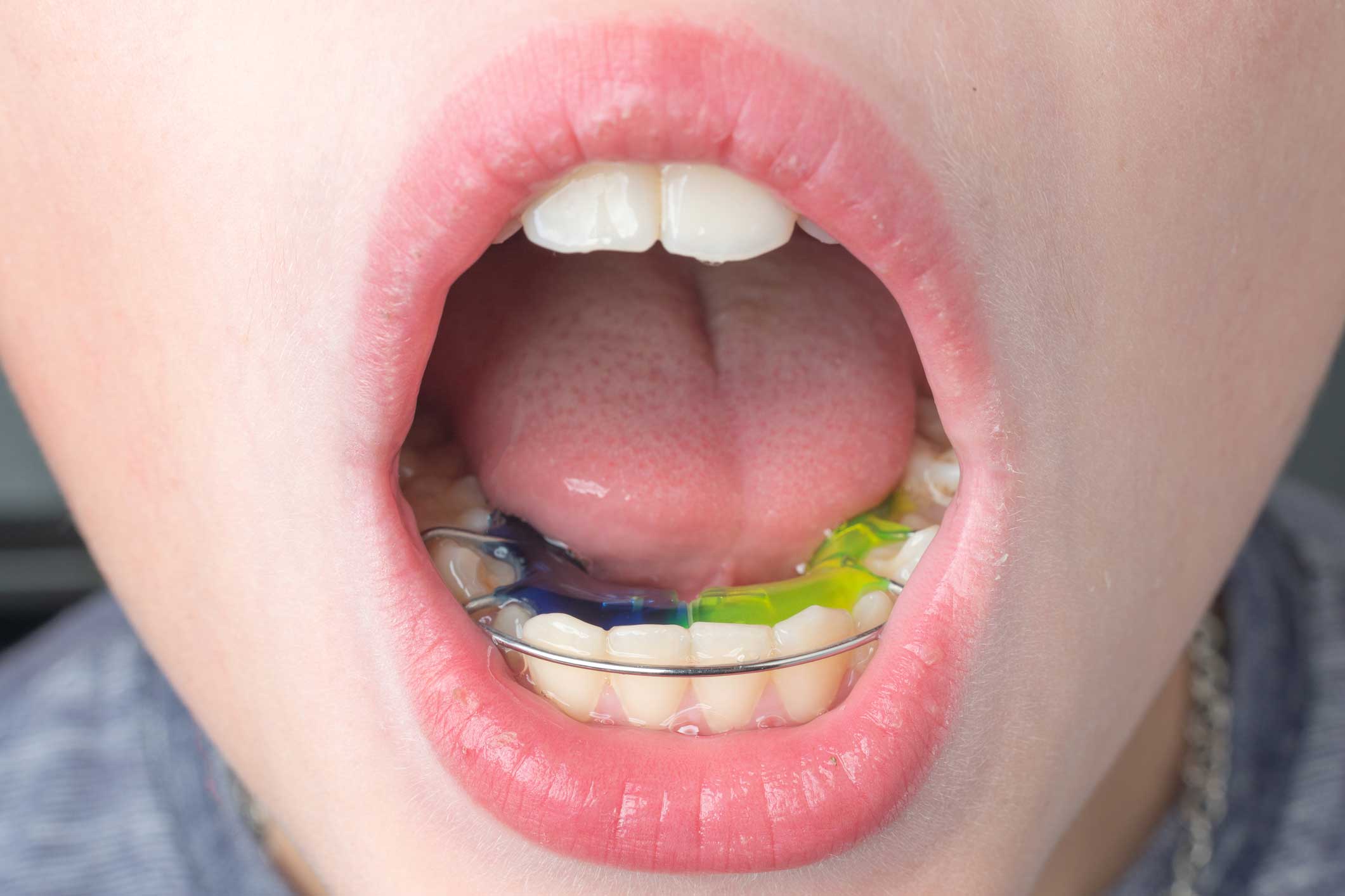 Odontopediatría en Retiro, dentista para niños en Retiro, clínica dental para niños en Retiro, odontopediatra en Retiro.