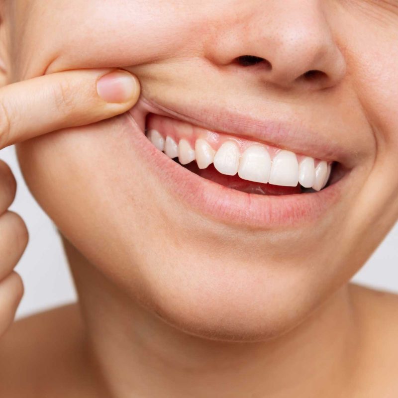 Periodoncia en Retiro, tratamientos de periodoncia en Retiro, Madrid; tratamiento para las encías en Retiro, curar las encías.